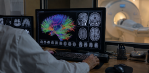 Brain scans and a multicolored map of neural pathways fill a radiology workstation screen as a patient lies inside an MRI scanner