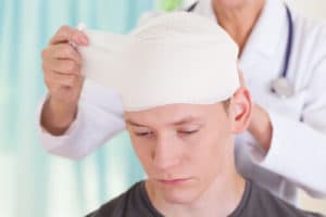 common causes of brain injury in Pasadena